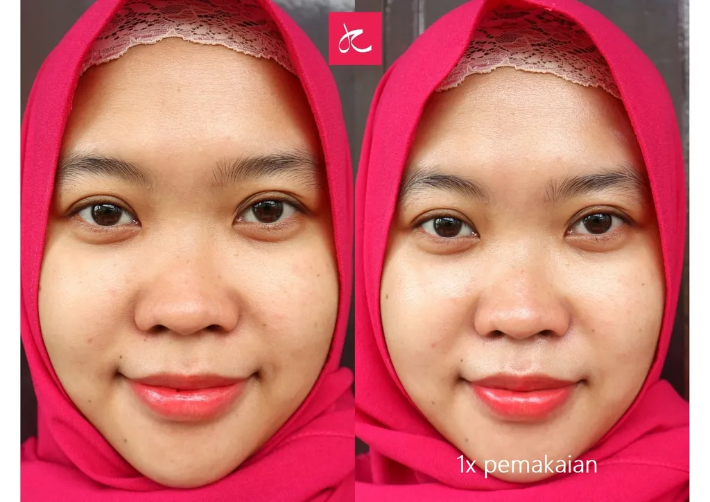 Review Olay total Effect 7-in-1 Day Cream Normal SPF 15 15