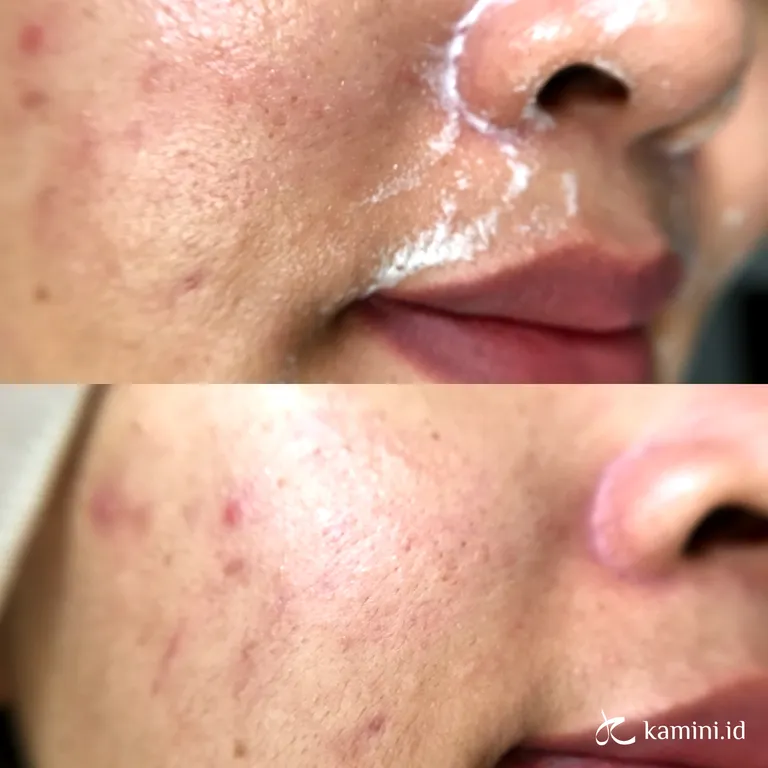 Review True To Skin Matcha Oat Gentle Cleanser, Ringan Gak Bikin Kesat