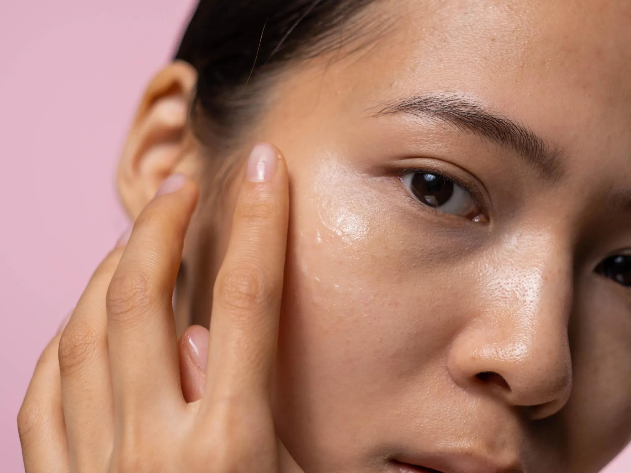 2. Penumpukan Sel Kulit Mati_