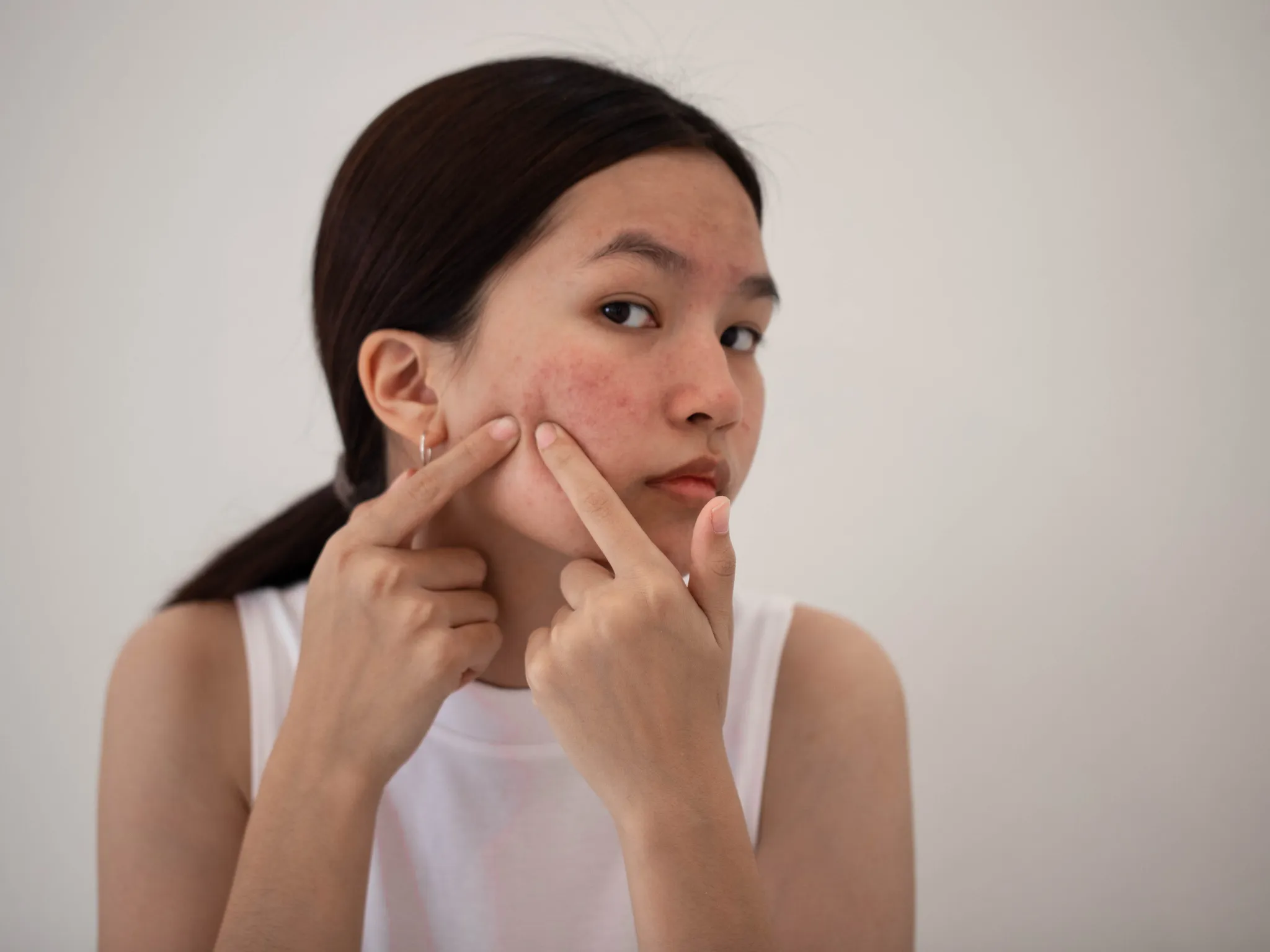 7. Kulit Sering Reaktif Terhadap Skincare_