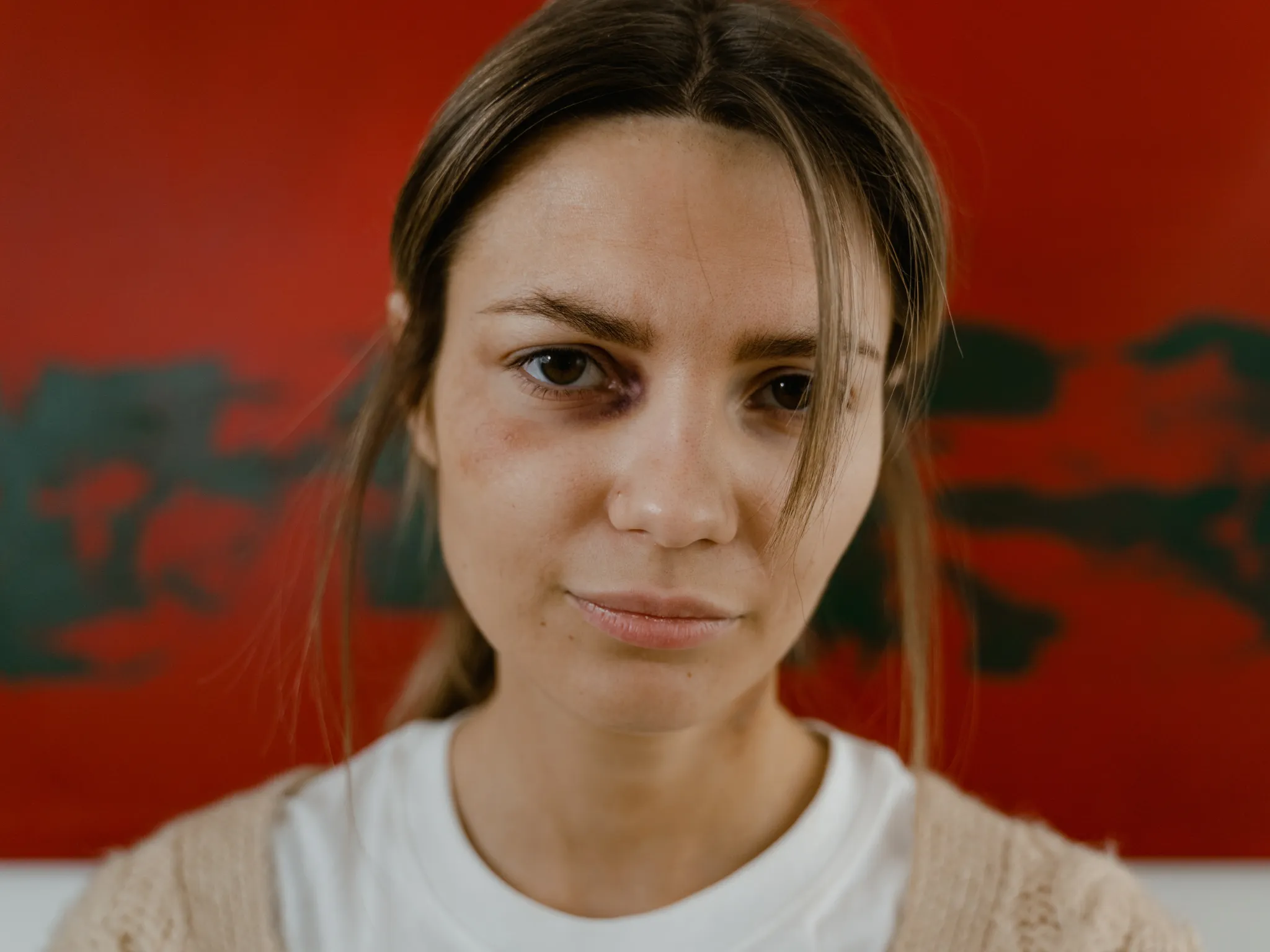 Apa Itu Physical Attack_