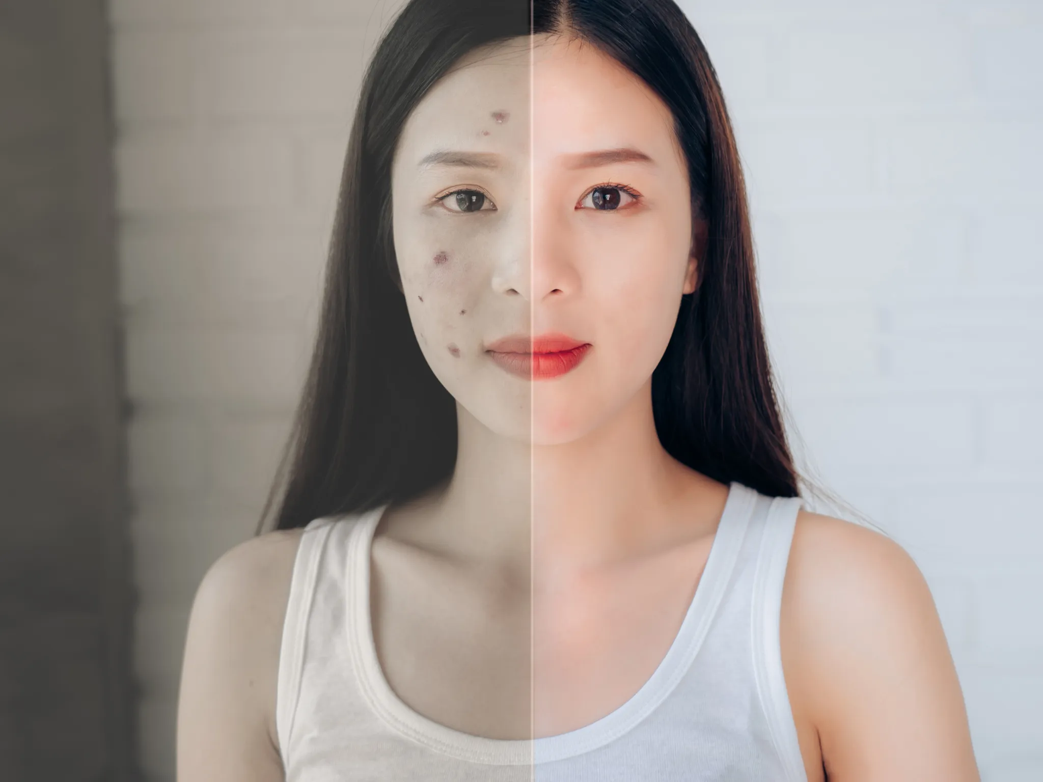 Dampak Positif Merawat Kulit Sejak Remaja_