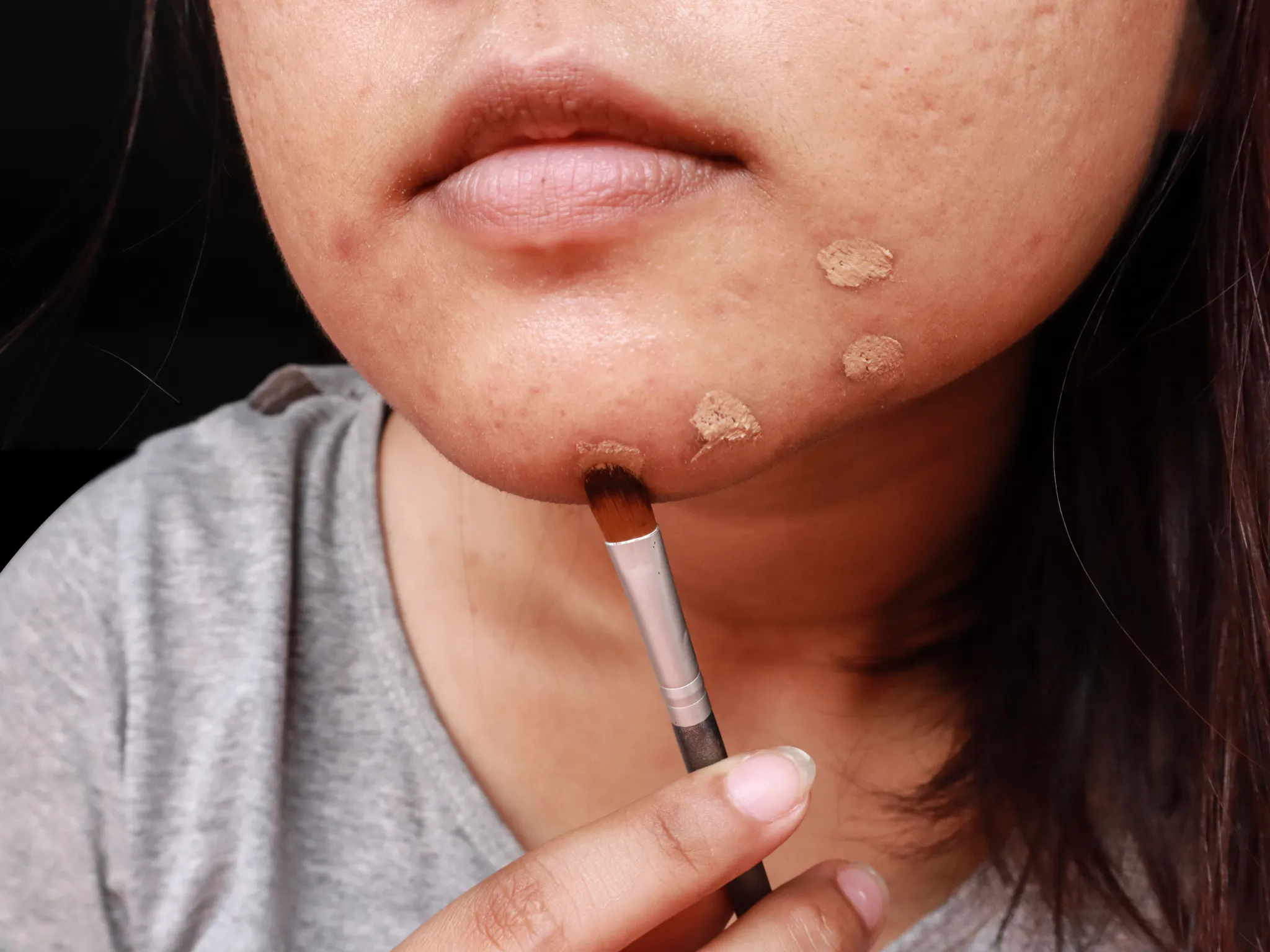 1. Menyamarkan Noda, Jerawat, dan Bekas Luka_