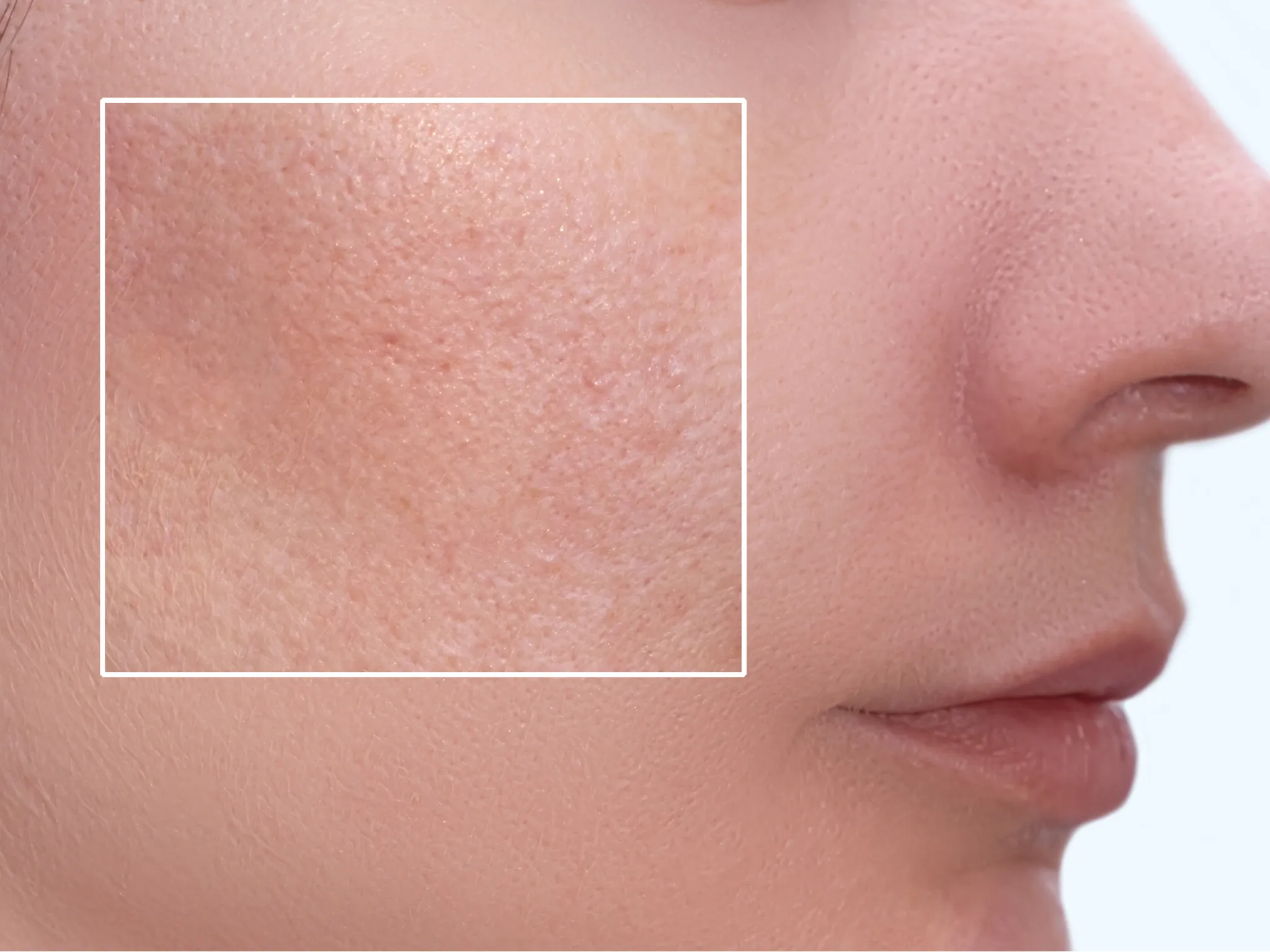 5. Mengecilkan Pori-Pori