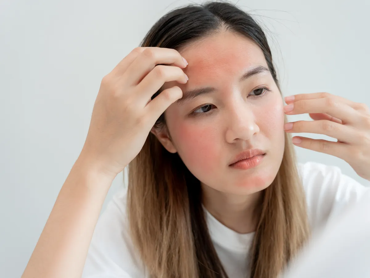 3. Kulit Tidak Bruntusan atau Jerawatan_