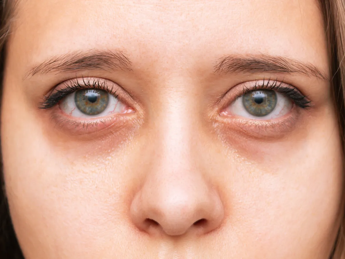 3. Menyamarkan Lingkar Hitam di Bawah Mata_