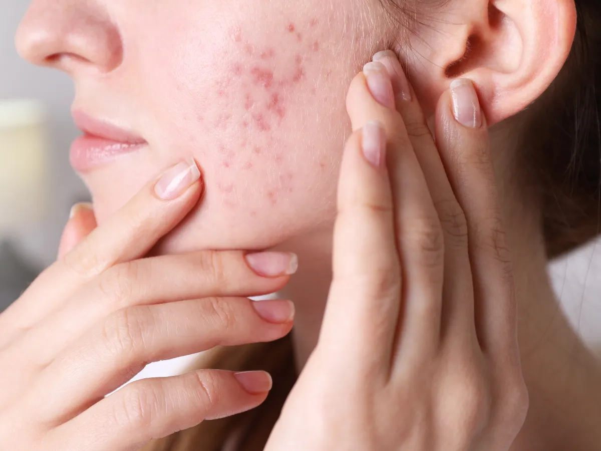 8. Bedakan Purging dan Nggak Cocok_