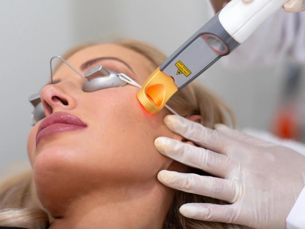 Laser Vascular
